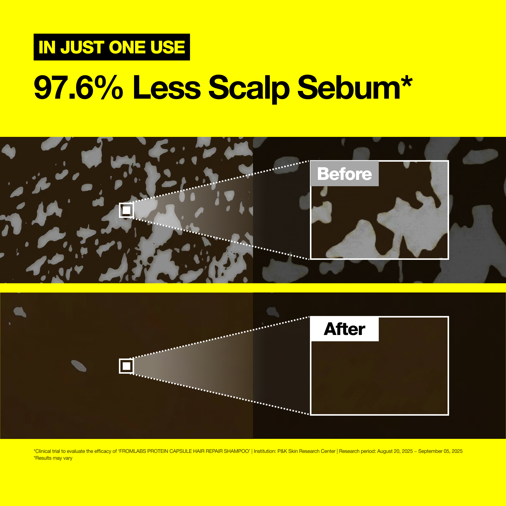 The Ultimate Glass Hair Set (Mask + Booster + Leave-In + Shampoo)